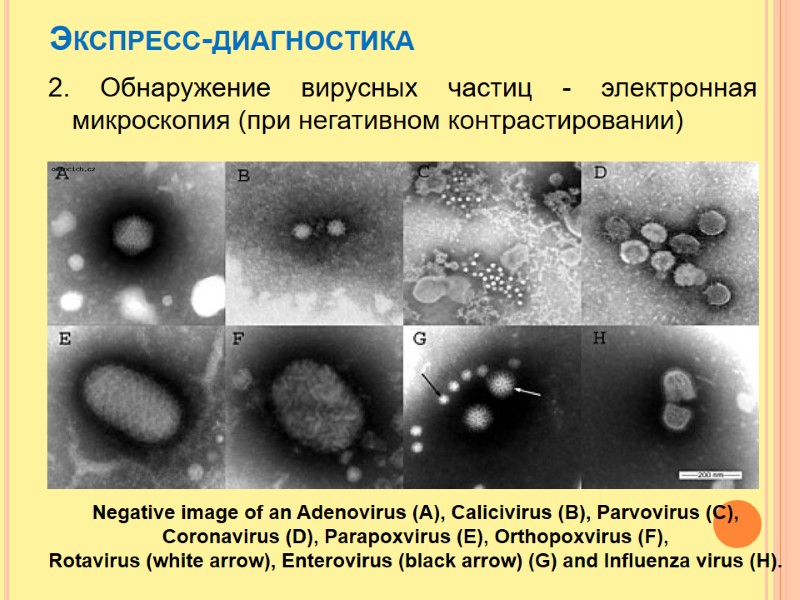 Экспресс-диагностика 2. Обнаружение вирусных частиц - электронная микроскопия (при негативном контрастировании)   